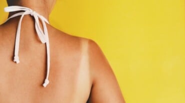 A woman ready to use lavender oil for sunburn